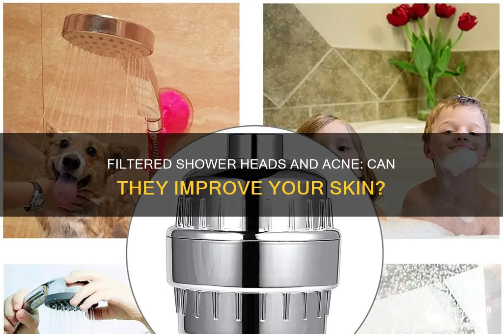 will a filtered shower head help with acne