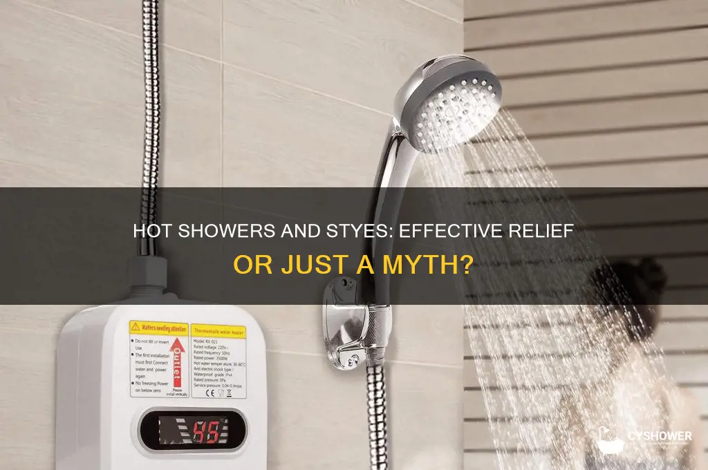 will a hot shower get rid of a stye