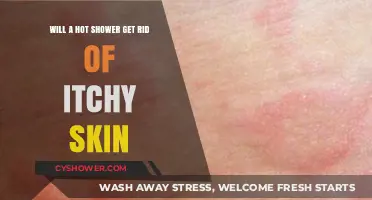 Hot Showers for Itchy Skin: Relief or Temporary Fix?