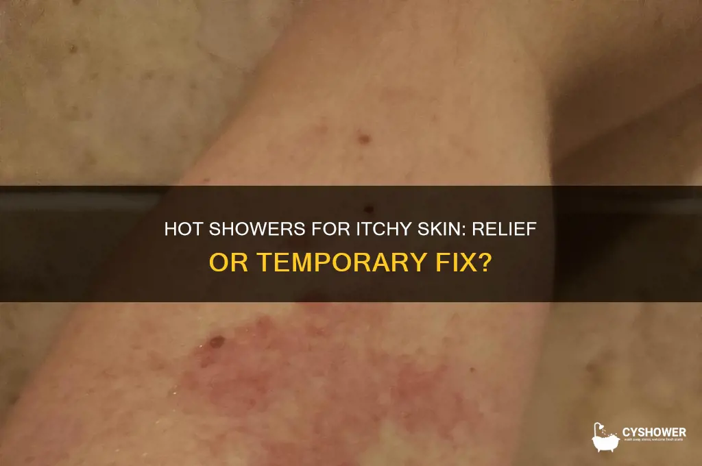 will a hot shower get rid of itchy skin