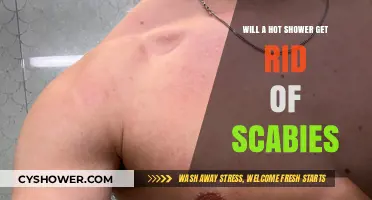 Hot Showers and Scabies: Effective Relief or Temporary Comfort?