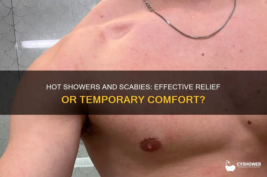 will a hot shower get rid of scabies