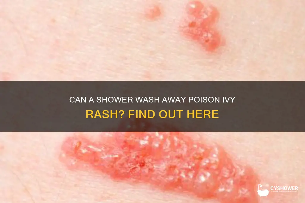 will a shower get rid of poison ivy