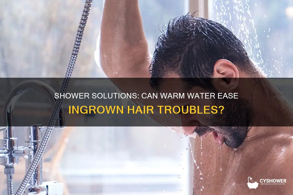 will a shower help a ingrown hair