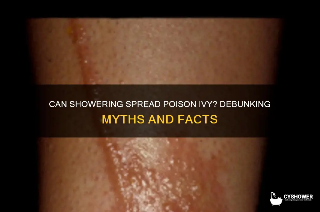 will poison ivy spread if i take a shower
