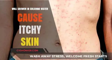 Chlorine Water Showers: Unraveling the Itchy Skin Connection