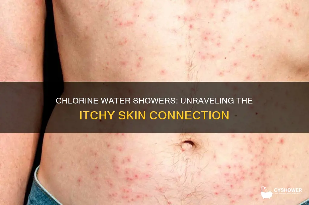 will shower in chlorine water cause itchy skin