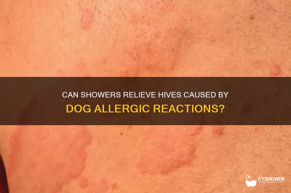 will shower remove hives after reaction from dogs