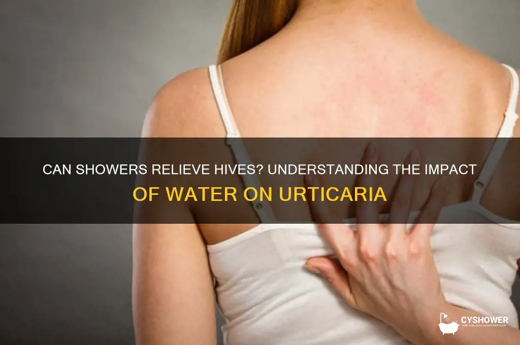 will shower remove hives