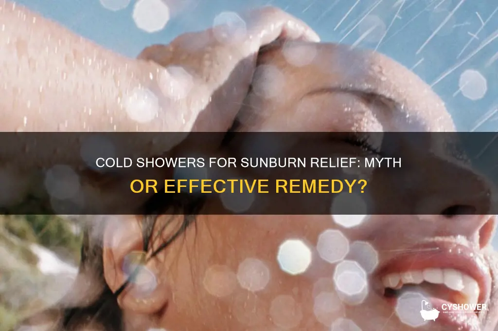 will taking a shower in cold water help a sunburn