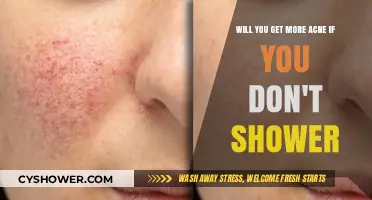 Skipping Showers and Acne: Does Lack of Hygiene Worsen Breakouts?