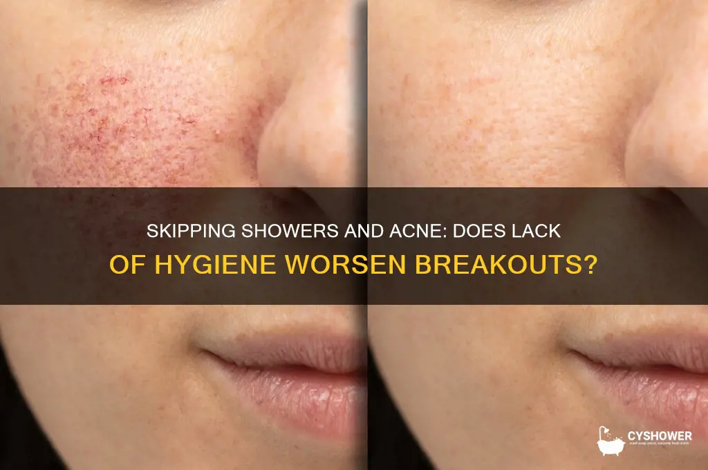 will you get more acne if you don